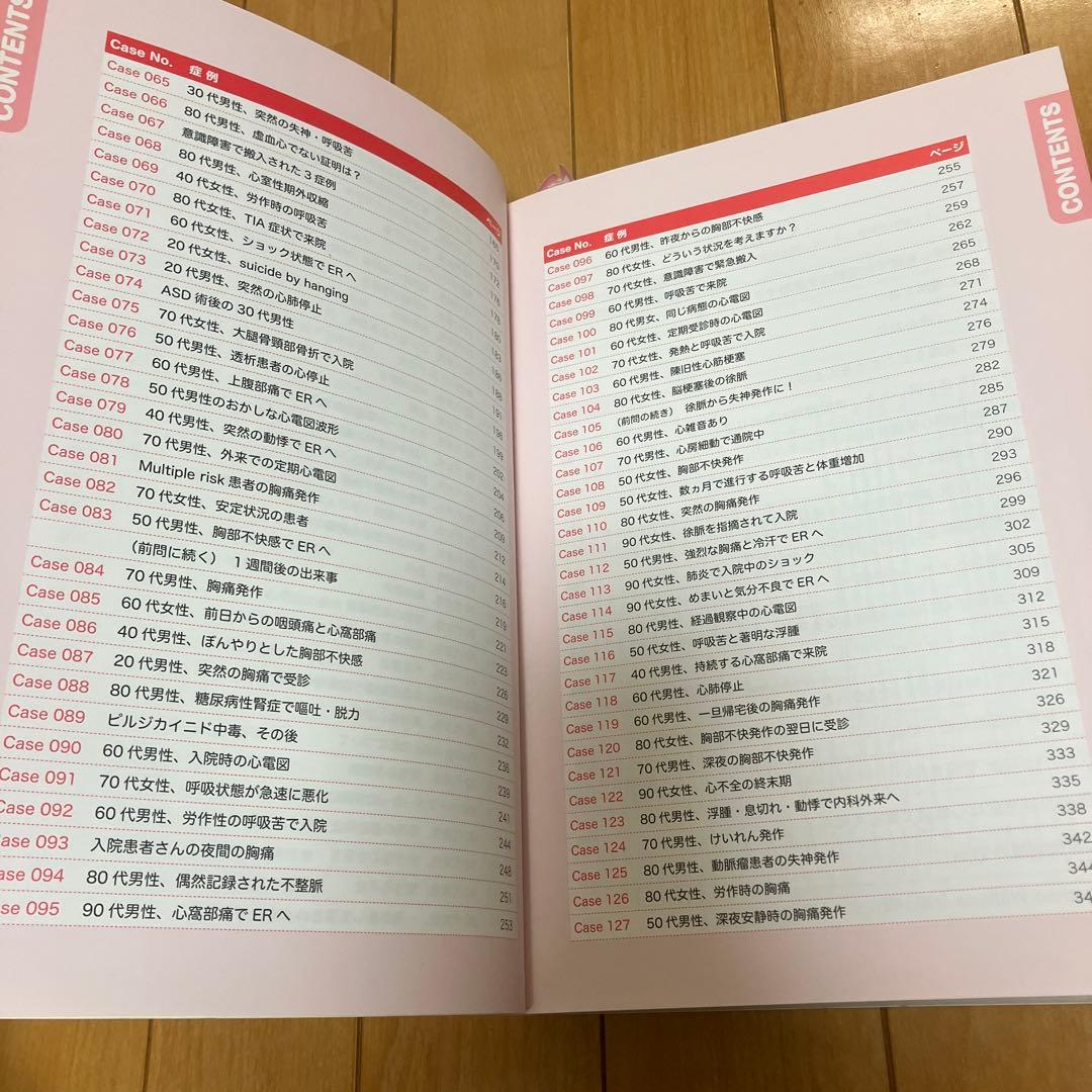 危ない心電図の見分け方他3冊