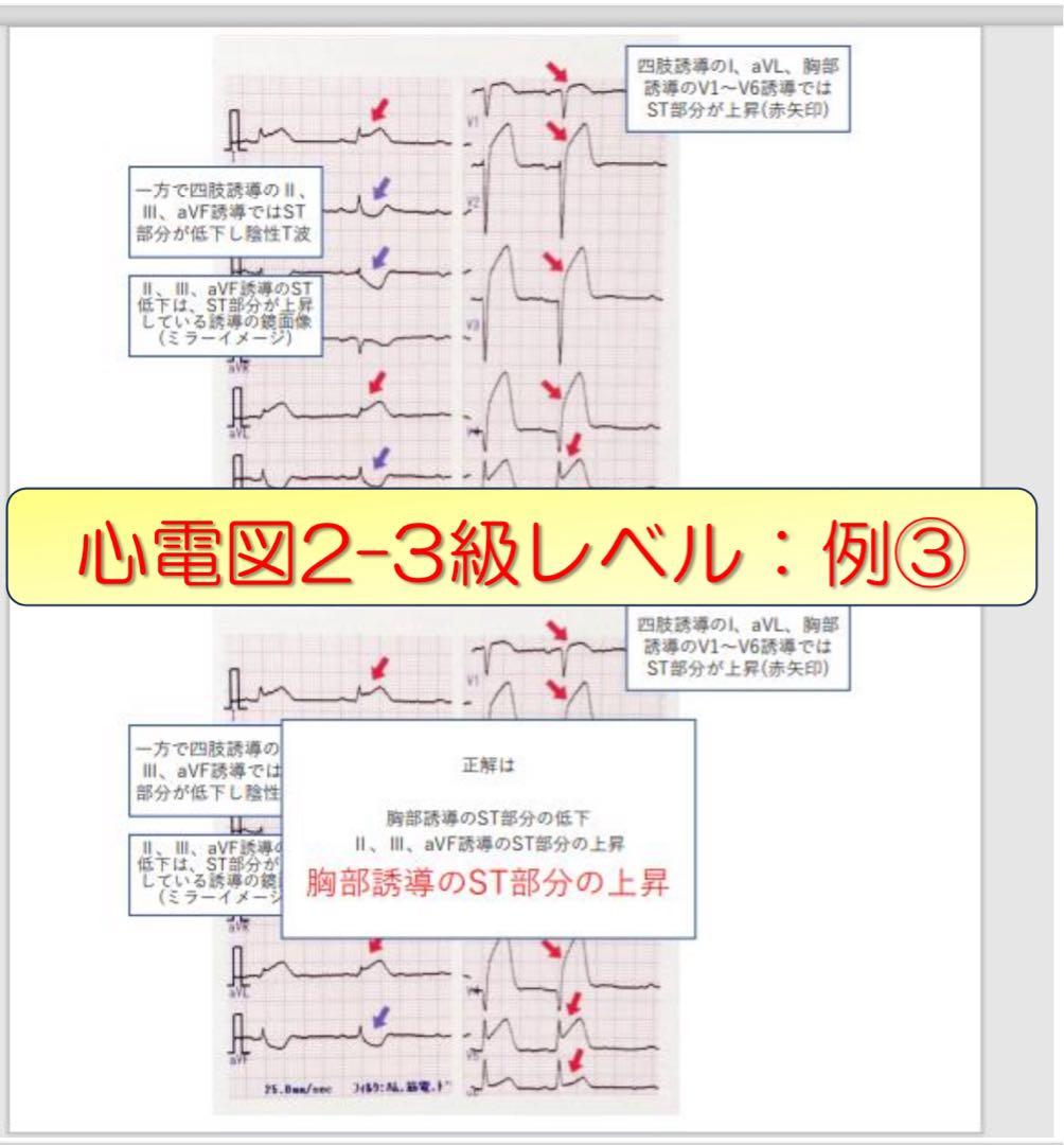 心電図検定対策7点セット