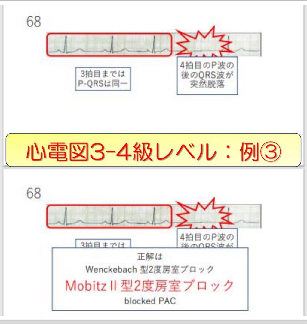 心電図検定対策7点セット