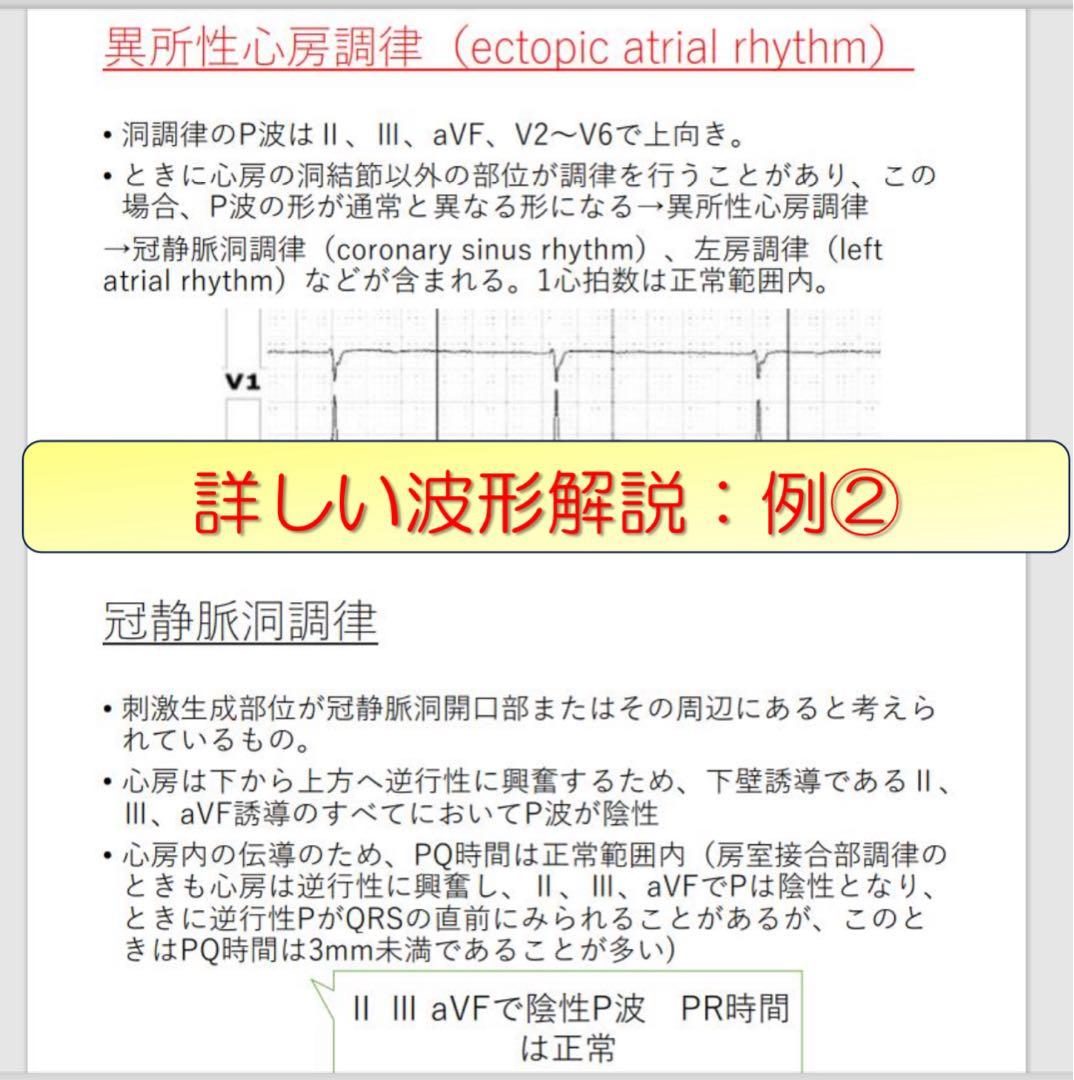 心電図検定対策7点セット